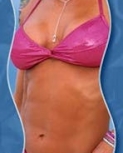 Filename=divasprofile4.jpg
Filesize=10KiB
Dimensions=148x266
Date added=Jan 29, 2016 divasprofile4.jpg